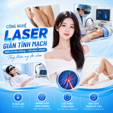 Laser Trị Giãn Tĩnh Mạch – Giải Pháp Hiện Đại Giúp Cải Thiện Tĩnh Mạch Hiệu Quả