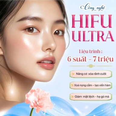 HIFU ULTRA : XÓA RÃNH CƯỜI - XÓA NỌNG CẰM