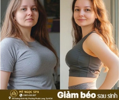 GIẢM MỠ SAU SINH 